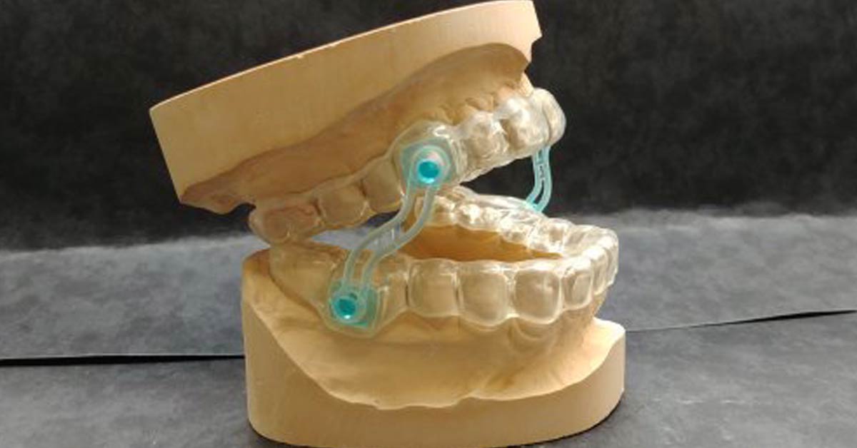 D'Email et D'Ivoire - Laboratoire de Prothèse dentaire - Gouttières  protège-dents